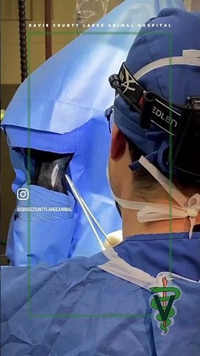Neurectomy Surgery