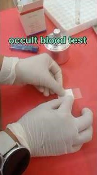 fecal /stool occult blood test//procedure//interpretation