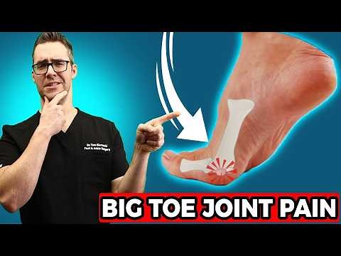 BEST Sesamoiditis Treatment [Big Toe Joint Pain & Big Toe Treatment]