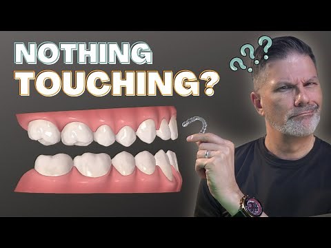 How to understand the bite jump in the Invisalign clear aligners ClinCheck software?