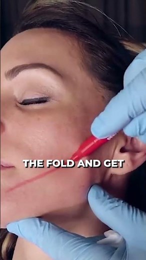 PDO FACELIFT How I Do It!! Lift Your Face