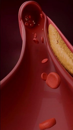 Increase Cholesterol in ANIMATION! The ULTIMATE Guide to High Cholesterol!