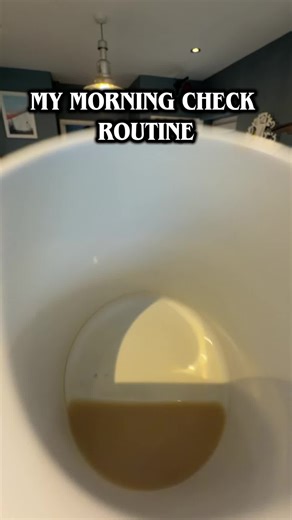 My Morning Routine After Tea and Checkups