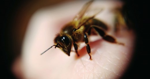 How to Treat a Bee Sting at Home (and When to Head to the Hospital)
