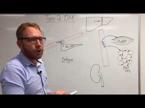 Type 2 Diabetes: Pathophysiology