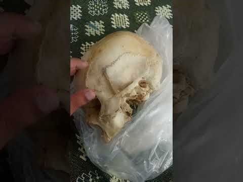 Temporal and infratemporal fossa boundaries