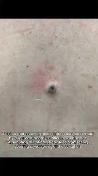 We ALWAYS Say Pops are like Snowflakes