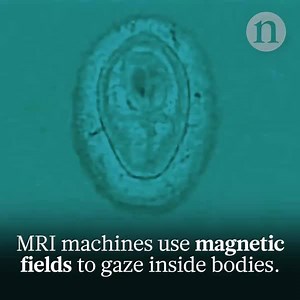 81K views · 676 reactions | The strongest MRI machine built to scan the human body uses a 10.5-tesla magnet, and more ultra-high-field scanners like this one are on the rise. Read more: https://go.nature.com/2LGfFCg | Nature | Facebook