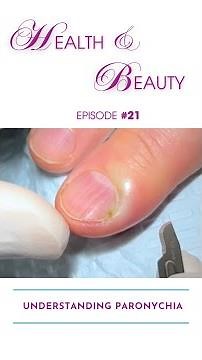 📚 Paronychia: What Causes It & How to Prevent It 💡