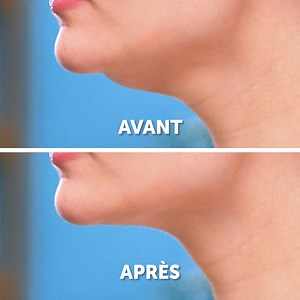 198K views · 47 reactions | 11 Exercices efficaces pour le rajeunissement du visage: | Sain et Sympa | Facebook