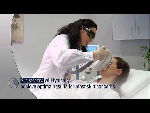 IPL Photofacial with Lumenis M22 at IGBeauty Laser & Skin Clinic