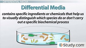How can we use differential media to distinguish bacterial species? [2025] | QAQooking.wiki