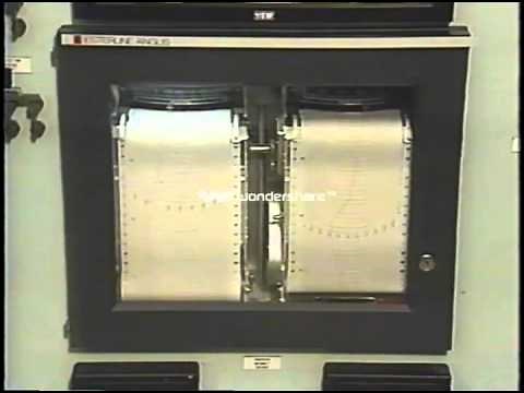 Instrumentation Loop Diagrams