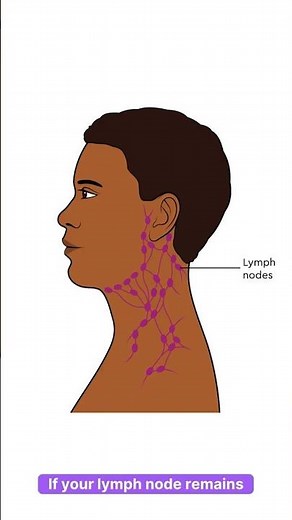Swollen Lymph Nodes? Signs You Shouldn’t Ignore!