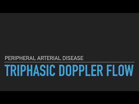 Triphasic Doppler Flow