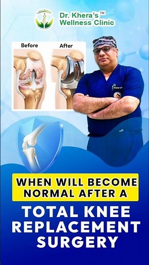 Recovery Timeline After Total Knee Replacement: Week-by-Week Progress