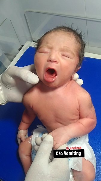 👶 Baby with Vomiting Complaint | Pediatric Case