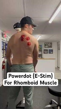 How to Use Powerdot (E-stim) for Rhomboid Muscle
