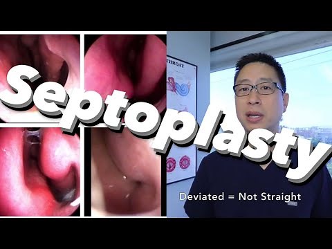Septoplasty Overview (and all things Septum): symptoms, anatomy, surgery.