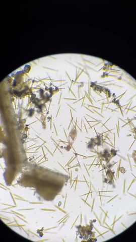 Microscopic World: A Tiny Universe You’ve Never Seen Before