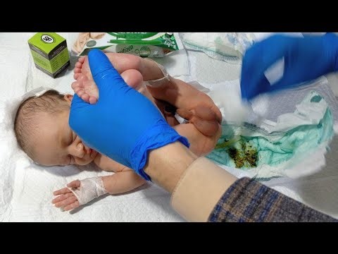 How to Change Diaper in a Newborn Baby | Step-by-Step NICU Procedure | Neonatal Care