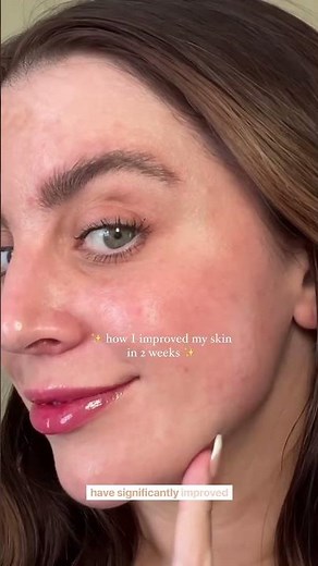 Proactiv MD 3-Step Routine🩵