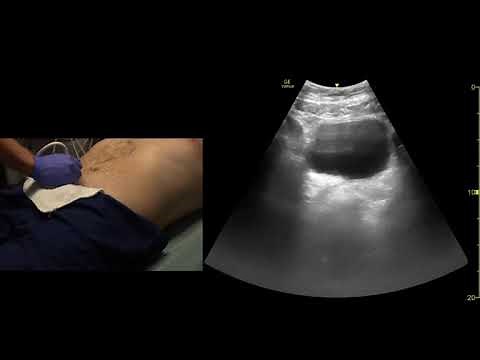 FAST Exam Scanning Technique