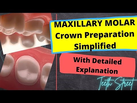 Maxillary Molar Crown Preparation Technique Made EASY! (Metal Crown)
