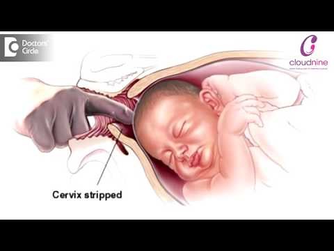 Methods of Labour Induction - Dr. Padmini Isaac | Cloudnine Hospitals