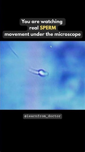 Real Sperm Movement Under the Microscope | Fertility Explained