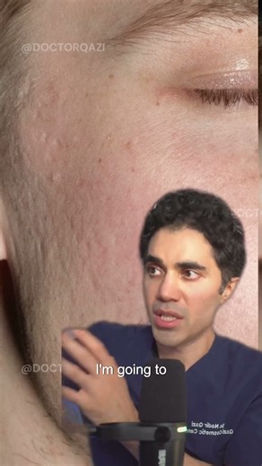 How We Tailor Treatments for Patients That Are Higher on the Fitzpatrick Scale