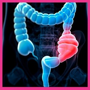 Constipation After Colonoscopy: Causes & Tips to treat - Oh My Gut