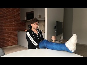 Daniel with his first Long leg cast - LLC