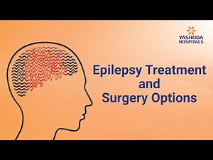 Epilepsy Treatment and Surgery Options | Causes and Symptoms of Epilepsy | Yashoda Hospitals