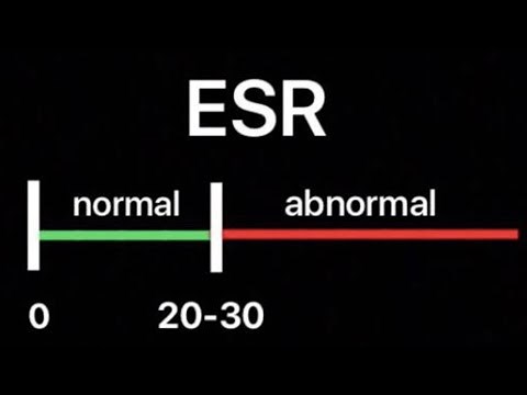 What is Normal ESR Levels | Normal range of ESR Test | What does it mean if your ESR is high?