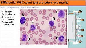 Differential WBC Count Test Procedure | Lab Tests Guide