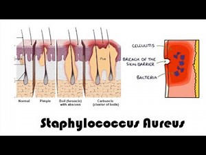 Staphylococcus aureus | complete overview | microbiology