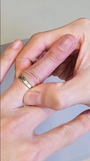 ER Doctor’s Trick to Remove a Stuck Ring! Use a String