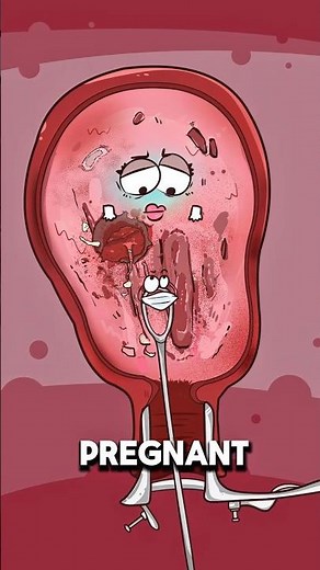Why She Couldn’t Get Pregnant After Multiple Cleanings 😔💔..!!#animation #2dshow #fypシ #health
