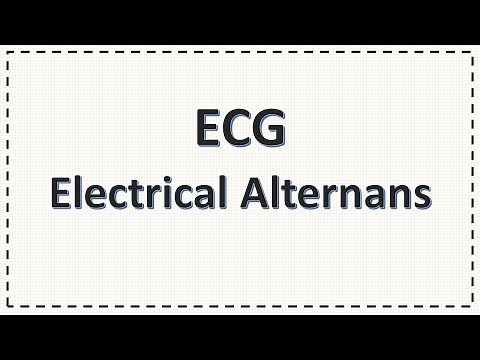 Electrical Alternans ECG | Pericardial Effusion | Cardiac Taponade | Simplified