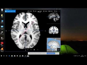 Dicom Image Viewer for Windows