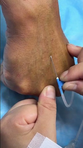 Intramuscular Injection Technique Explained | Safe IM Injection Step-by-Step | Nurse Guide Class 33
