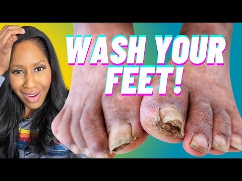 How to WASH YOUR FEET!🦶+How OFTEN to Wash Your Feet! A Doctor Explains