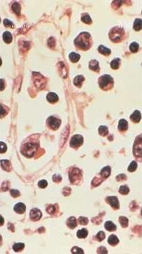 How Dangerous Is Hantavirus?