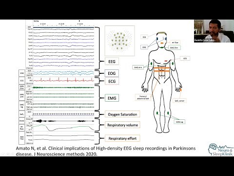 Polisomnografía en Medicina del Sueño.