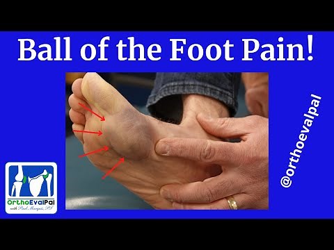 Ball of the Foot Pain
