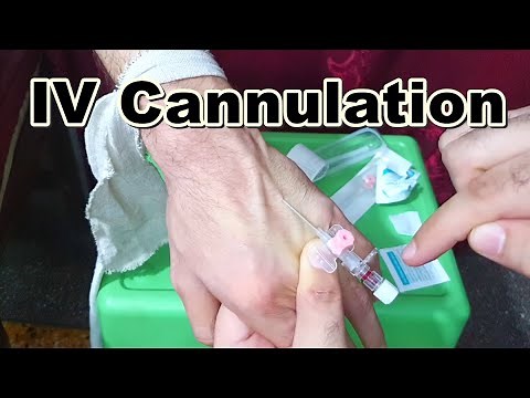How to Insert IV Cannula | IV Cannulation Technique | Branula | Intravenous Catheter
