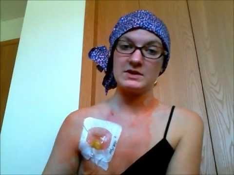 Port Placement Surgery