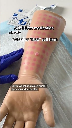 TB Skin Test 💉 #RN #BSN #futurenurse