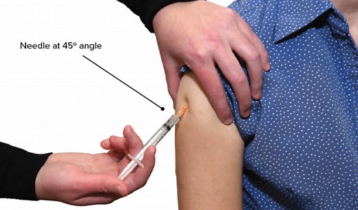 Subcutaneous injection sites, how to give subcutaneous injection & technique